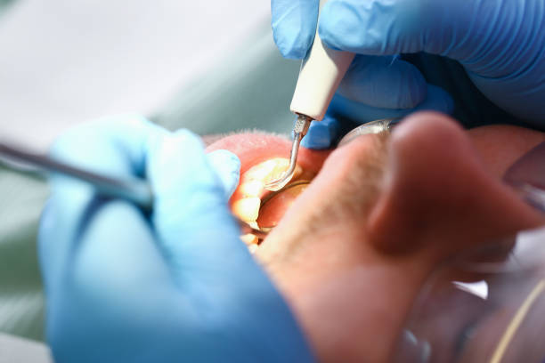 Best Tooth Pain Emergency Relief  in Dousman, WI