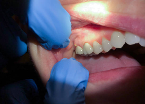 Best Broken Tooth Emergency  in Dousman, WI