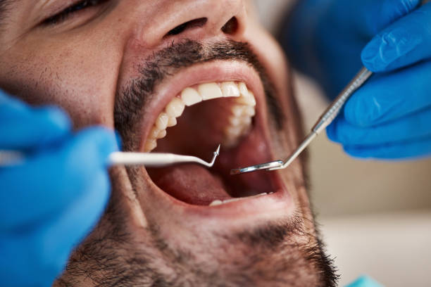 Best Chipped Tooth Repair Near Me  in Dousman, WI