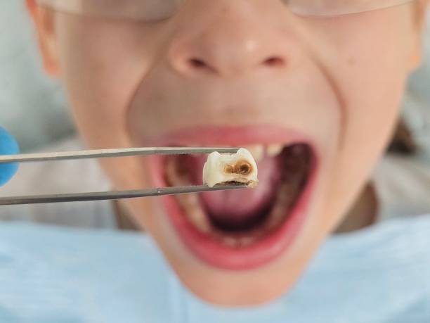 Best Tooth Pain Emergency Relief  in Dousman, WI